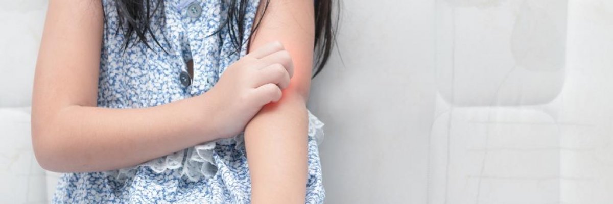 Szúnyogcsípés allergia gyerekeknél?