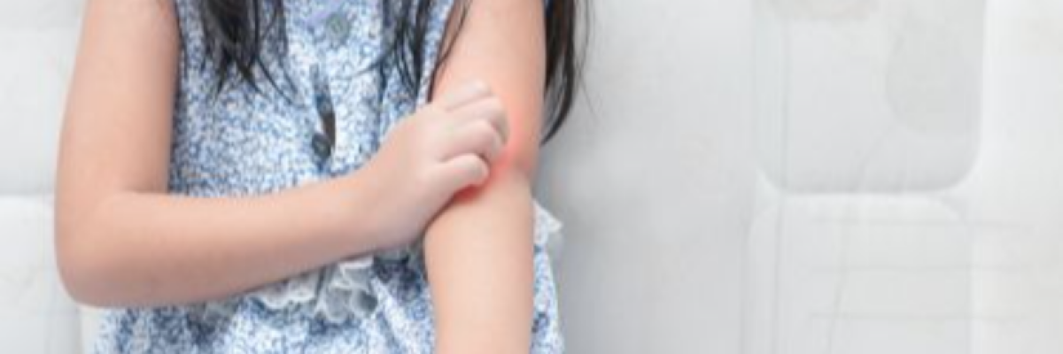 Atópiás dermatitisz vagy ekcéma? Ismerni kell az allergiás hátteret 