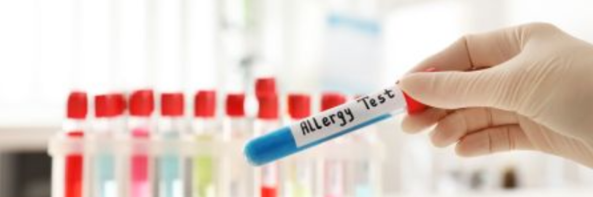 Parlagfű, fekete üröm allergia - Mikor kell elkezdeni a felkészülést a szezonra?