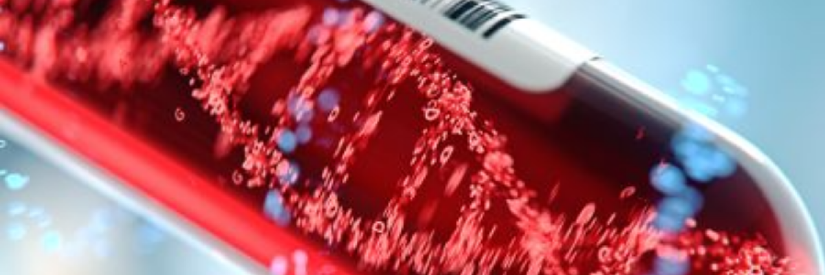 Komplex allergológiai kivizsgálás: mikor ajánlott több mint 300 allergént vizsgálni?