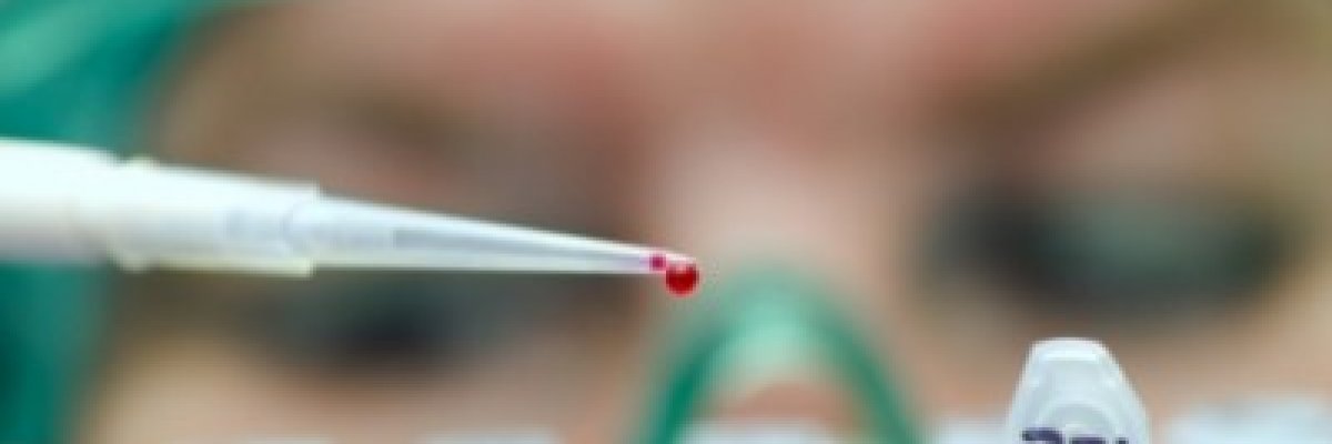 Segítség táplálékallergiásoknak: a komponens alapú allergia vizsgálat