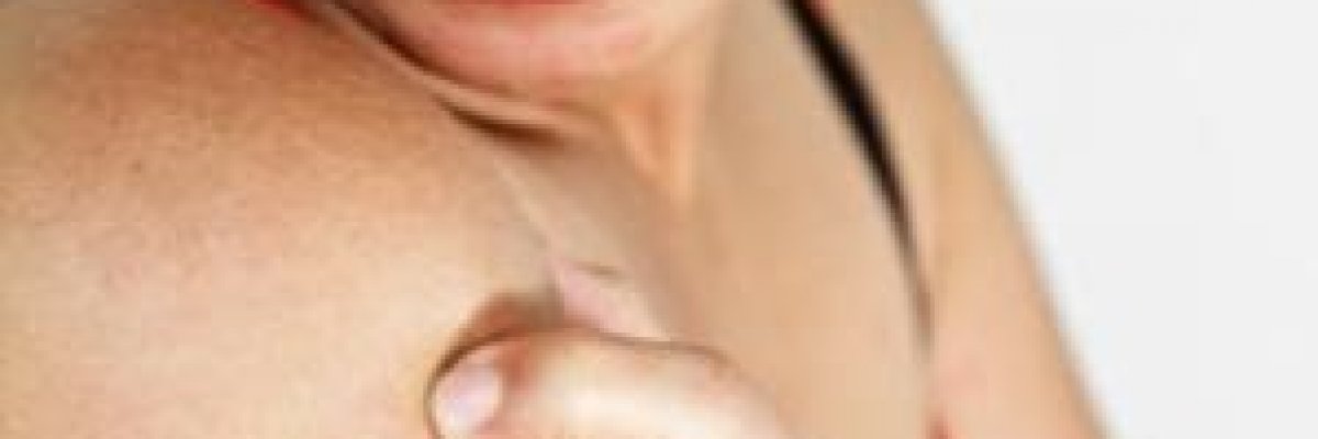 viszkető fejbőr vörös foltok pikkelyesek