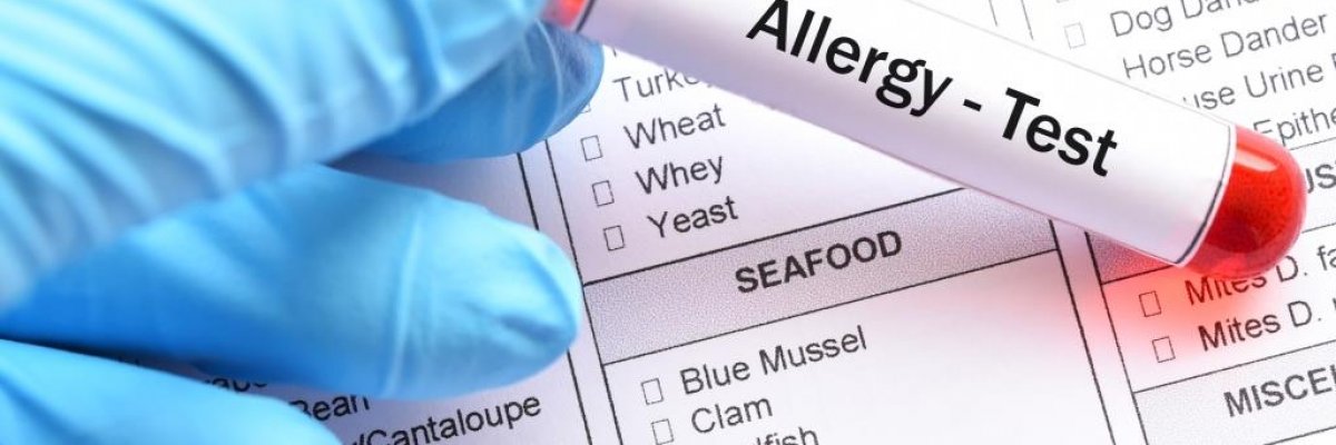 Allergia vizsgálat vérből – melyik teszt, mit mutat?