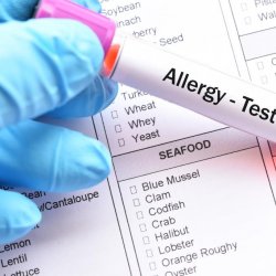 Melyik allergiatesztre van szükségem?