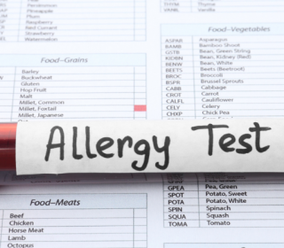 Komponens alapú allergia vizsgálat