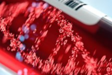 Komplex allergológiai kivizsgálás: mikor ajánlott több mint 300 allergént vizsgálni?