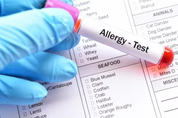 Melyik allergiatesztre van szükségem?