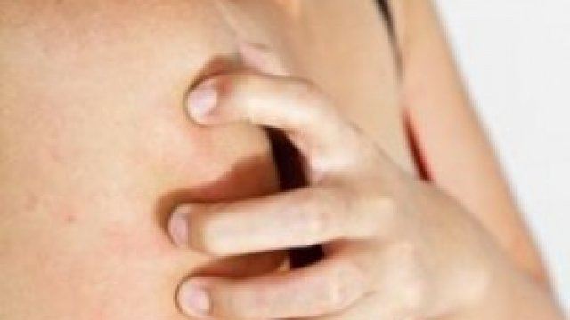 Fertőzés, vagy allergia is okozhatja a tetoválás utáni tüneteket