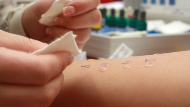 Tudnivalók az allergiás tünetek vizsgálatáról