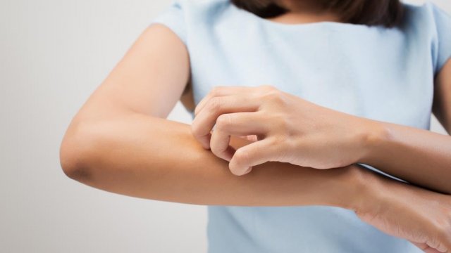 Október az ekcéma tudatosság hónapja
