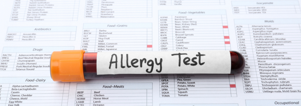 Komponens alapú allergiavizsgálat