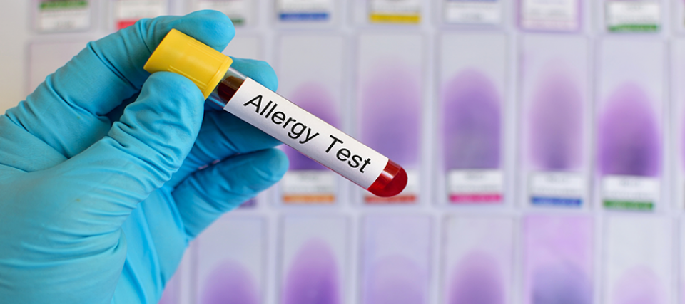 Allergia vizsgálatok