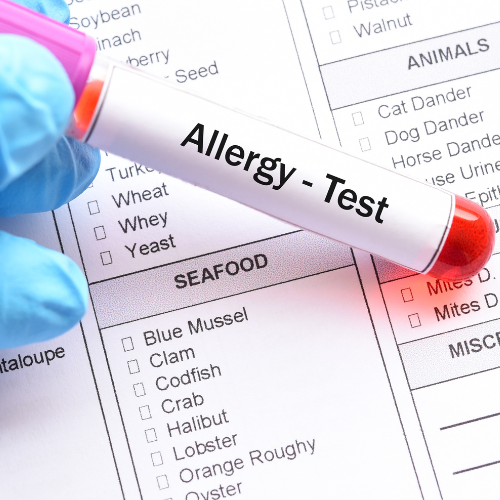  Alex, komplex allergia vizsgálat, teljes körű allergia vizsgálat, komplex allergia teszt, keresztallergia, komponens alapú diagnosztika, molekuláris allergia, allergiavizsgálat, multiplex allergia teszt, multiplex allergiateszt