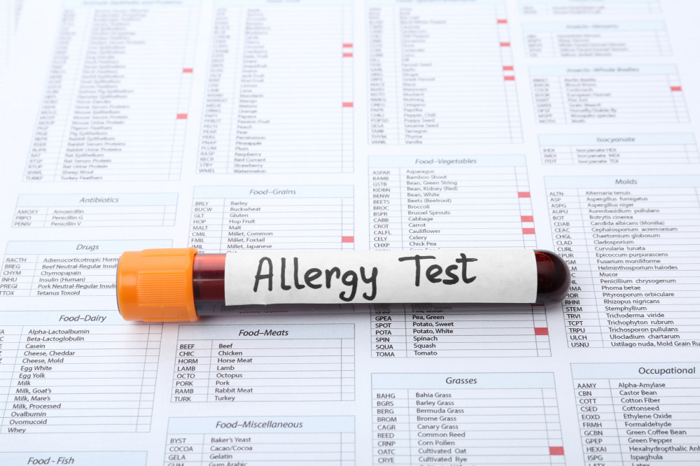 Parlagfű allergia kivizsgálása.
