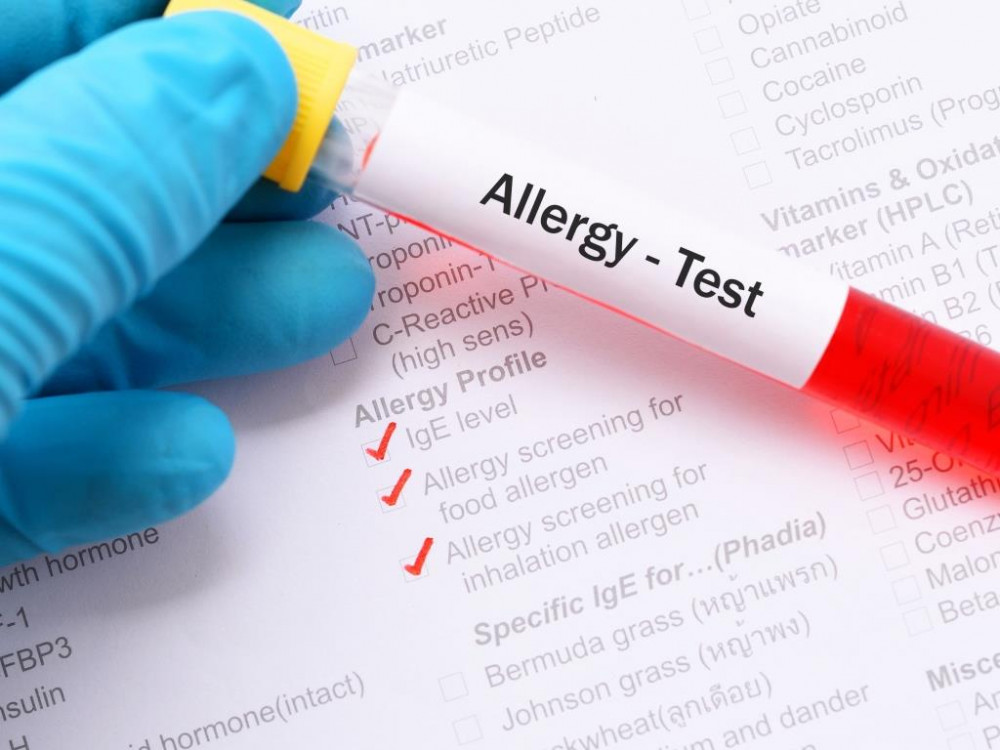 Ételallergia nutritív panel-allergia kimutatása vérből