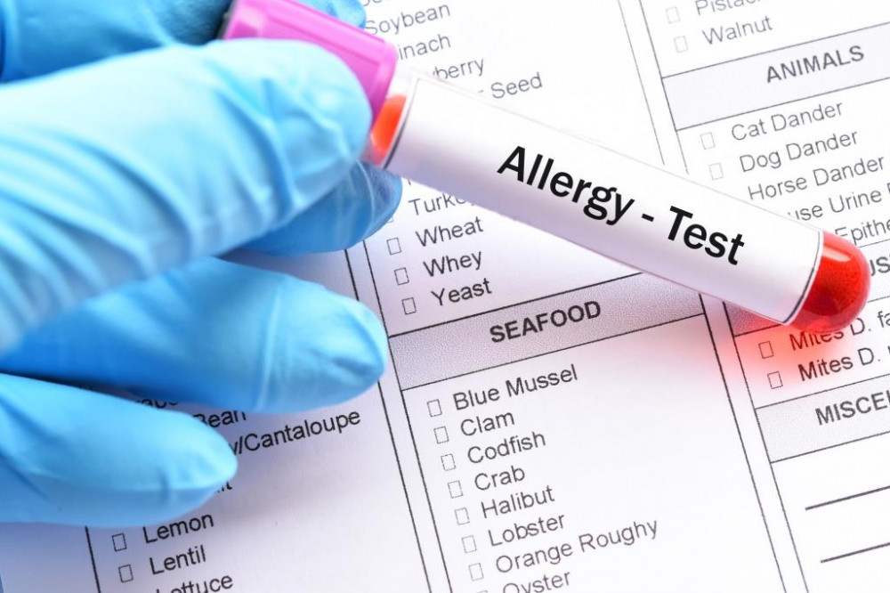 Az allergiavizsgálat menete, laborvizsgálat elvégzése.