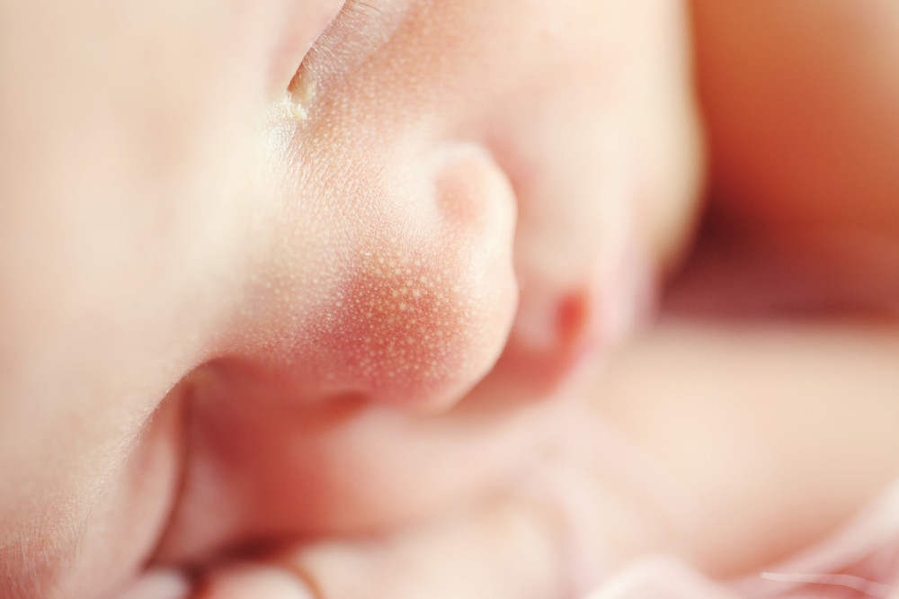 kiütés a bőrön vörös foltok formájában a csecsemőknél