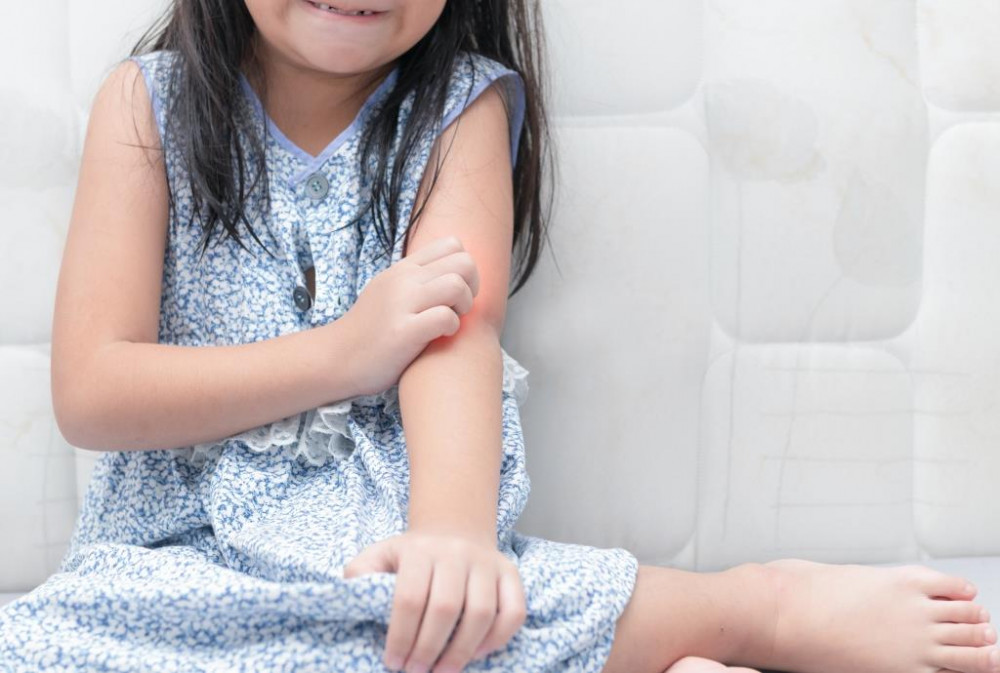 Rovarcsípés allergia kezelése gyerekeknél.