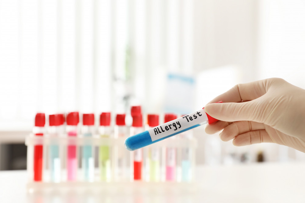 Faber, Alex, komplex allergia vizsgálat, teljes körű allergia vizsgálat, komplex allergia teszt, keresztallergia, komponens alapú diagnosztika, molekuláris allergia, allergiavizsgálat, multiplex allergia teszt, multiplex allergiateszt