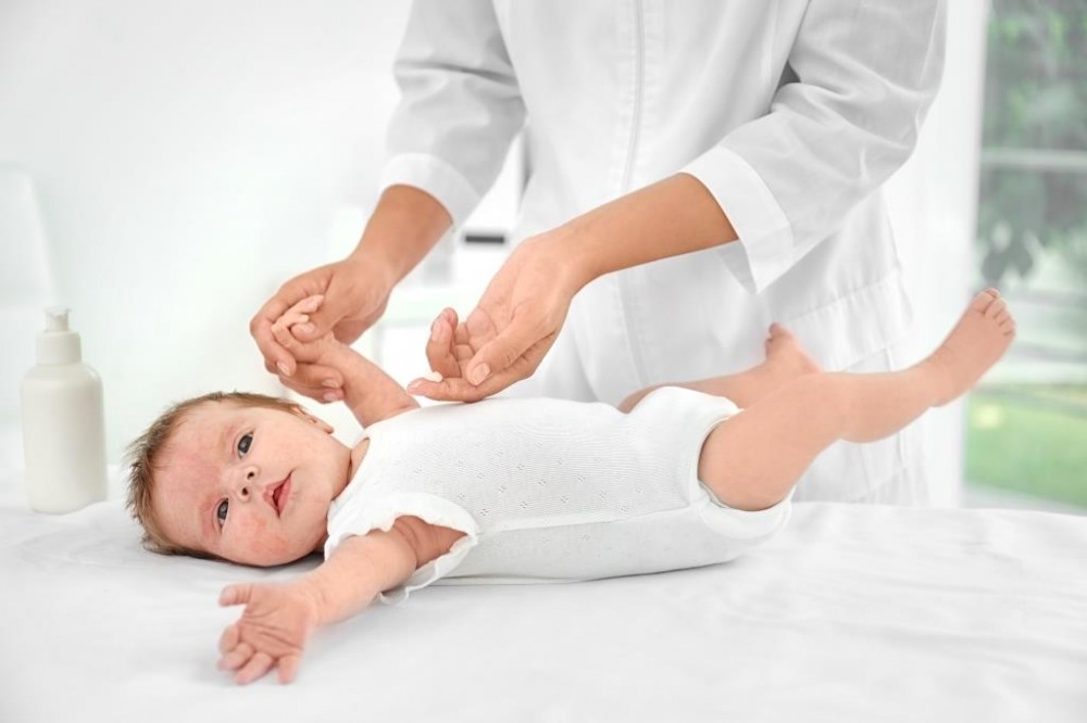 Tejallergia kivizsgálása csecsemő és gyermekgyógyász.
