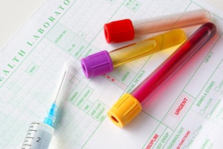 vérvizsgálat-allergia teszt