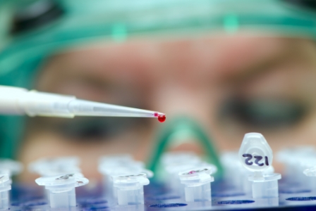komponens alapú allergia vizsgálat